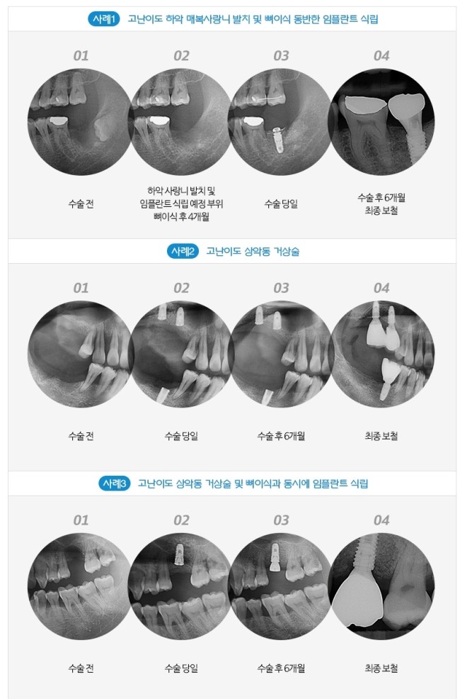 보스톤미소치과 이미지