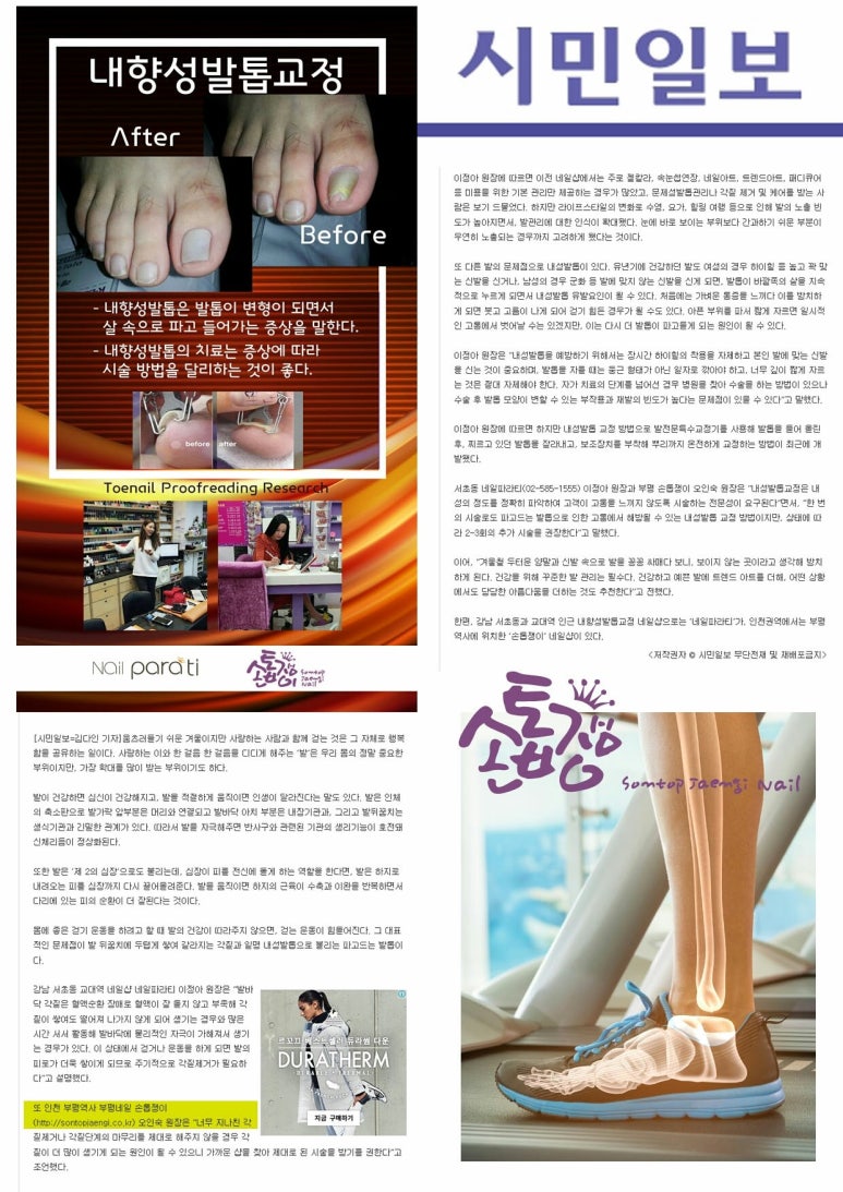 손톱쟁이 이미지