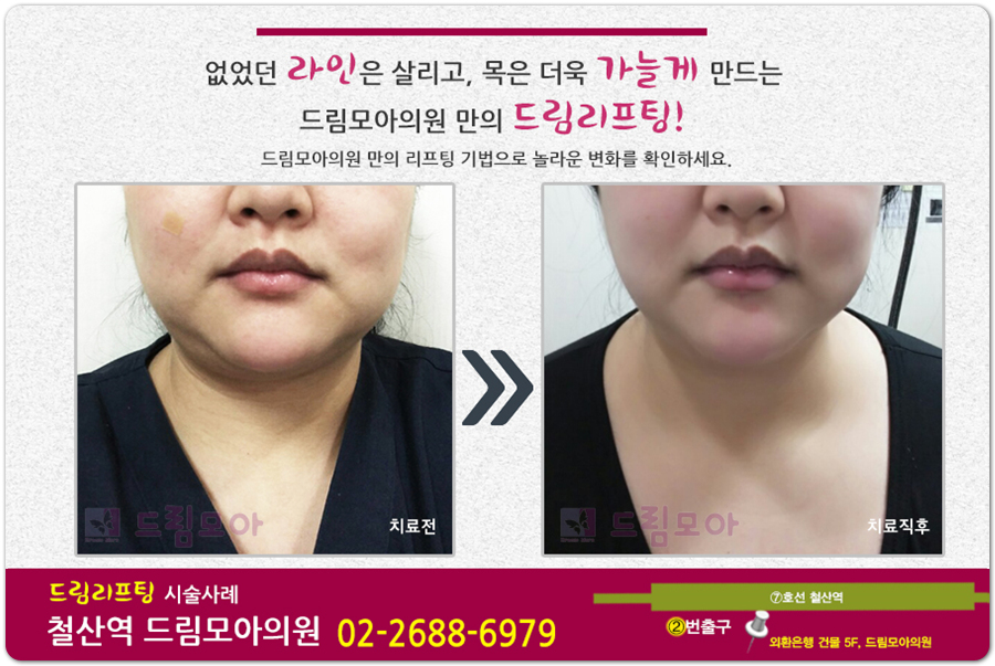 피부사랑피부과의원 이미지