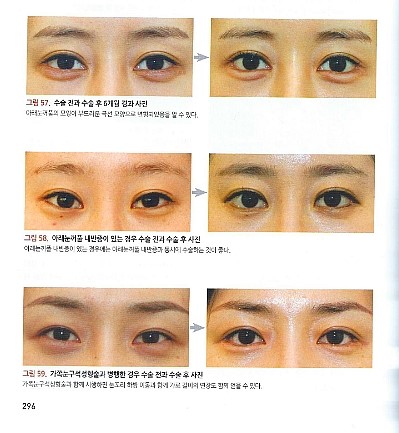 이앤비 이미지