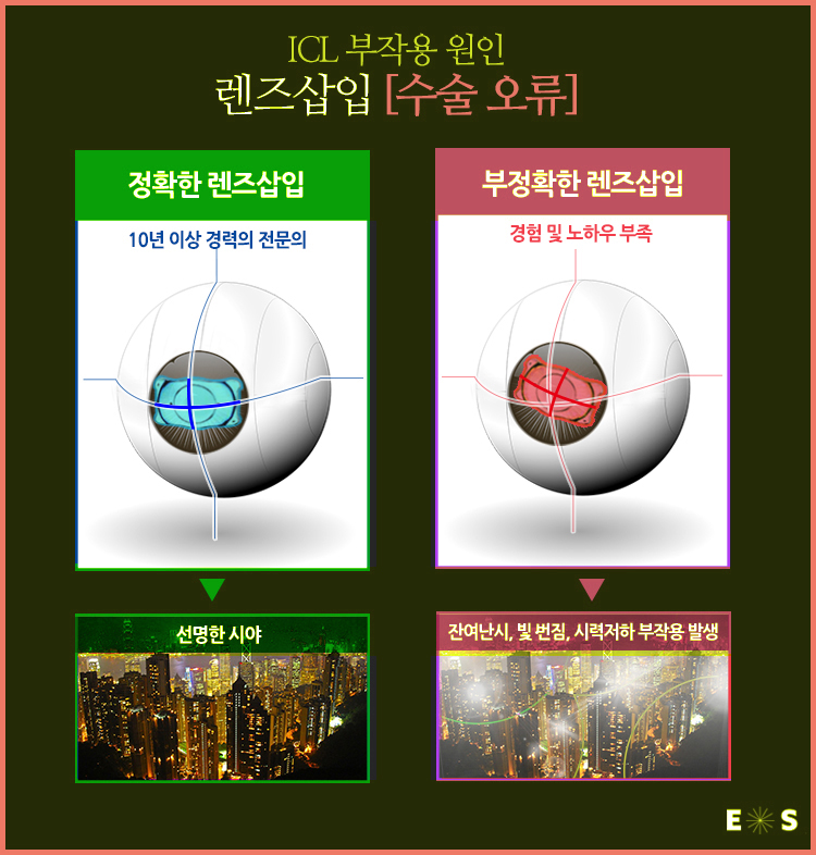 렌즈공간 이미지