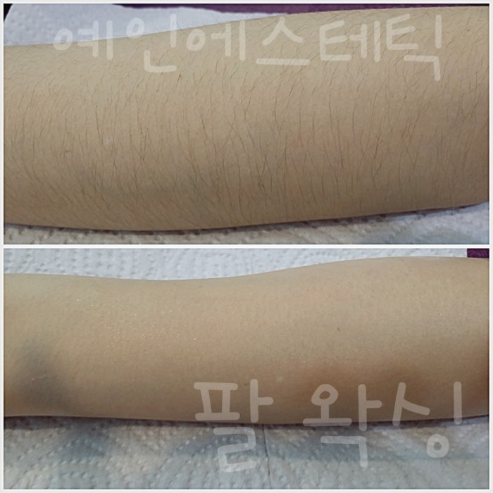 말끔왁싱 이미지