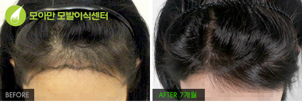 압구정헤어 이미지
