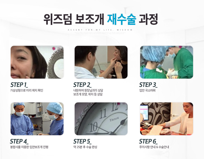 보조개1 이미지