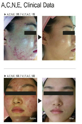 수피부 관리실 이미지