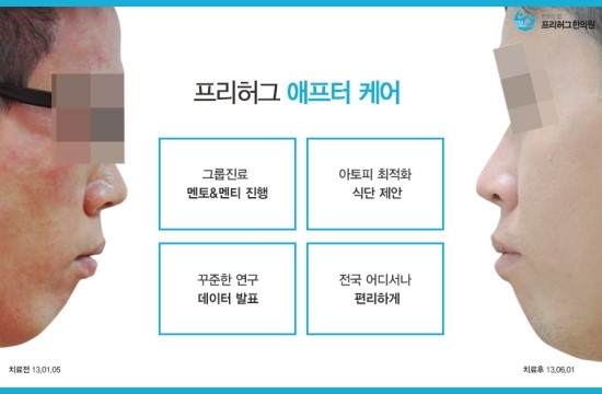 프리허그한의원 이미지