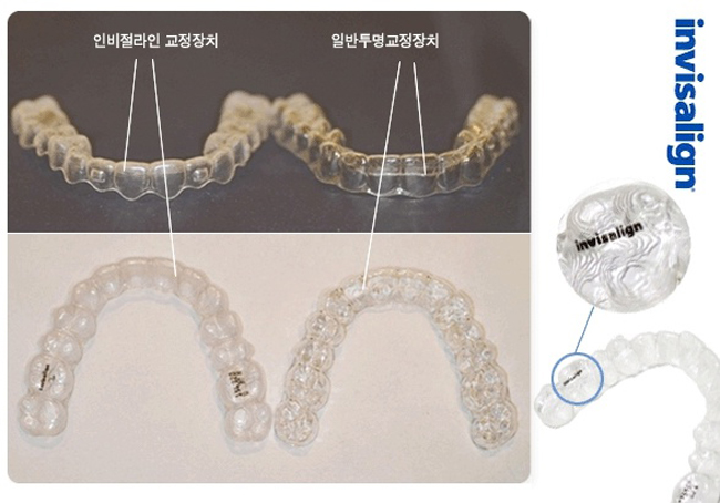 부여미소치과 이미지