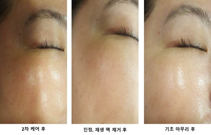 오광케어 이미지