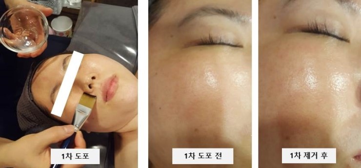 오광케어 이미지