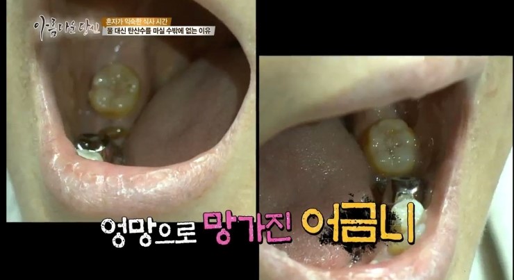 아당 이미지