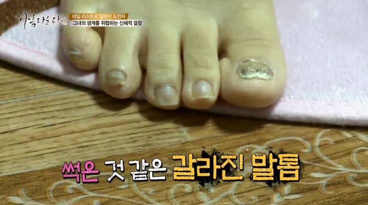 아당 이미지