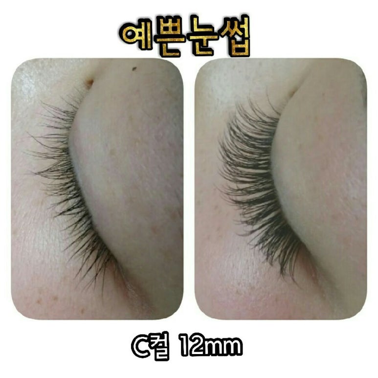 JC스킨케어 이미지