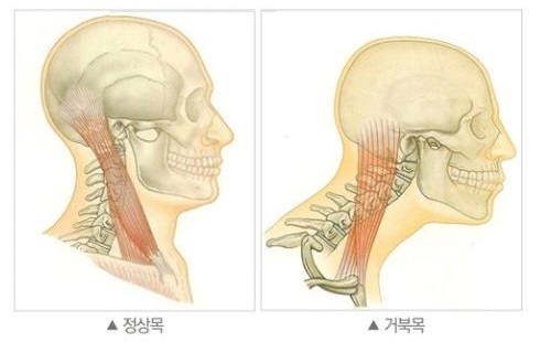 서울바른마취통증의학과 이미지