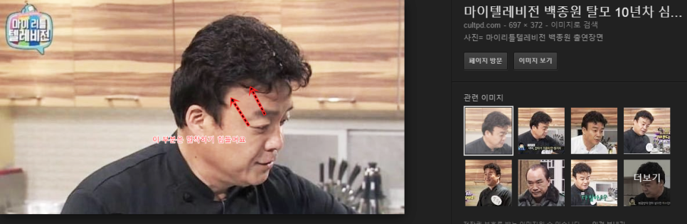 백가발 이미지