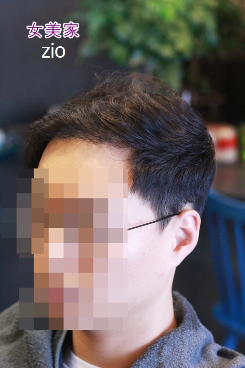 탈모헤어스타일 계선 탈모펌 하기 부산광안리미용실 여미가 : 네이버 블로그