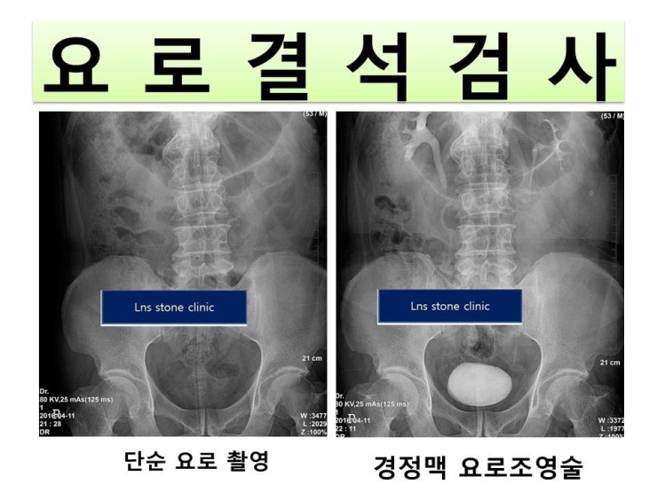 엘비뇨기과의원 이미지
