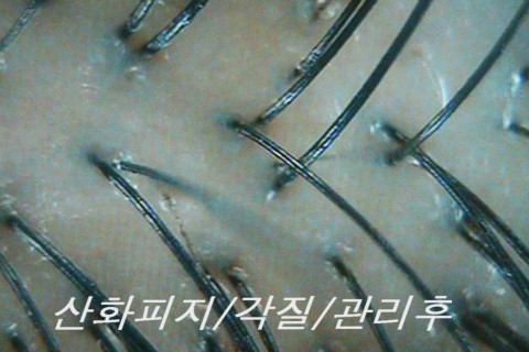 닥터포헤어안산 이미지