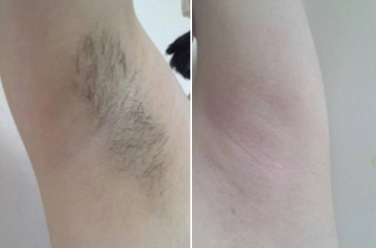 네일블라썸 이미지