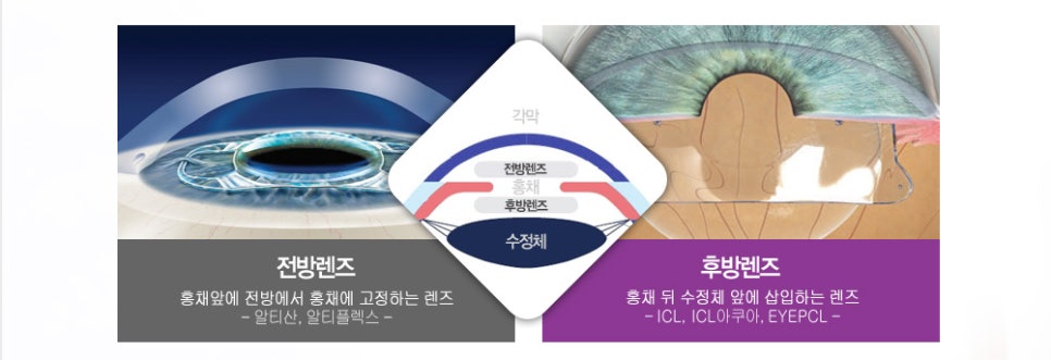 씨엘아이피 이미지