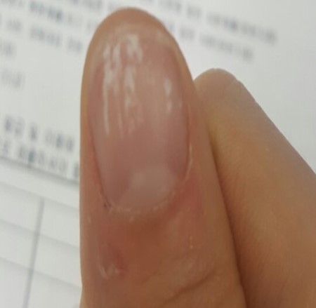 네일은;설렘 이미지