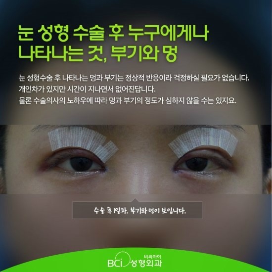 비씨아이 이미지