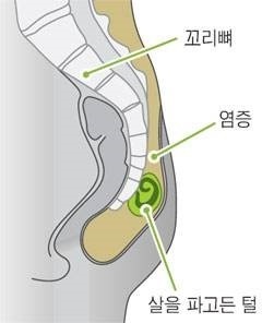 삼성항외과 이미지