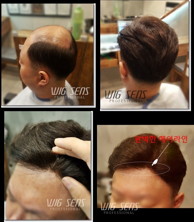 센스모위그 이미지
