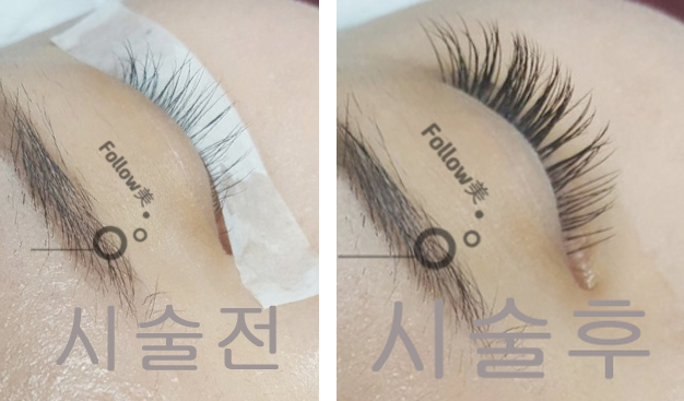 팔로우미네일 이미지
