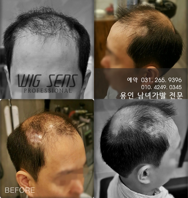 센스모위그 이미지