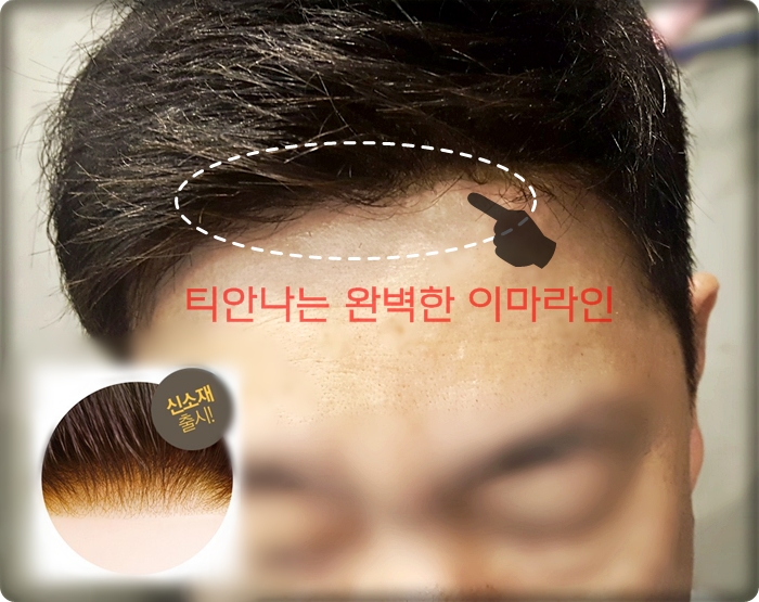 센스모위그 이미지
