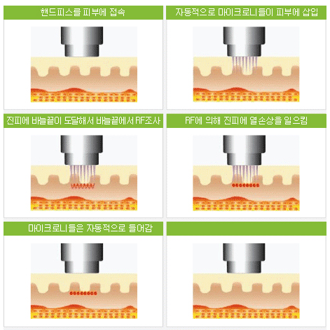 뷰티스 이미지