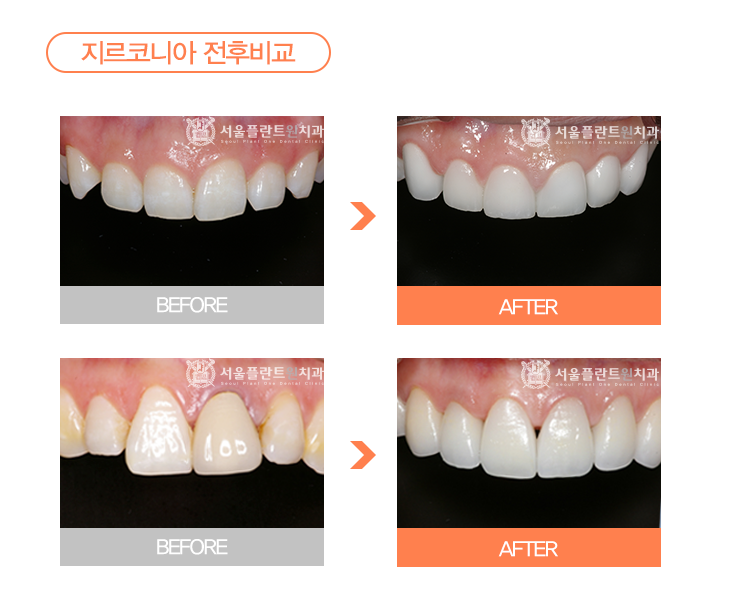 서울원치과 이미지