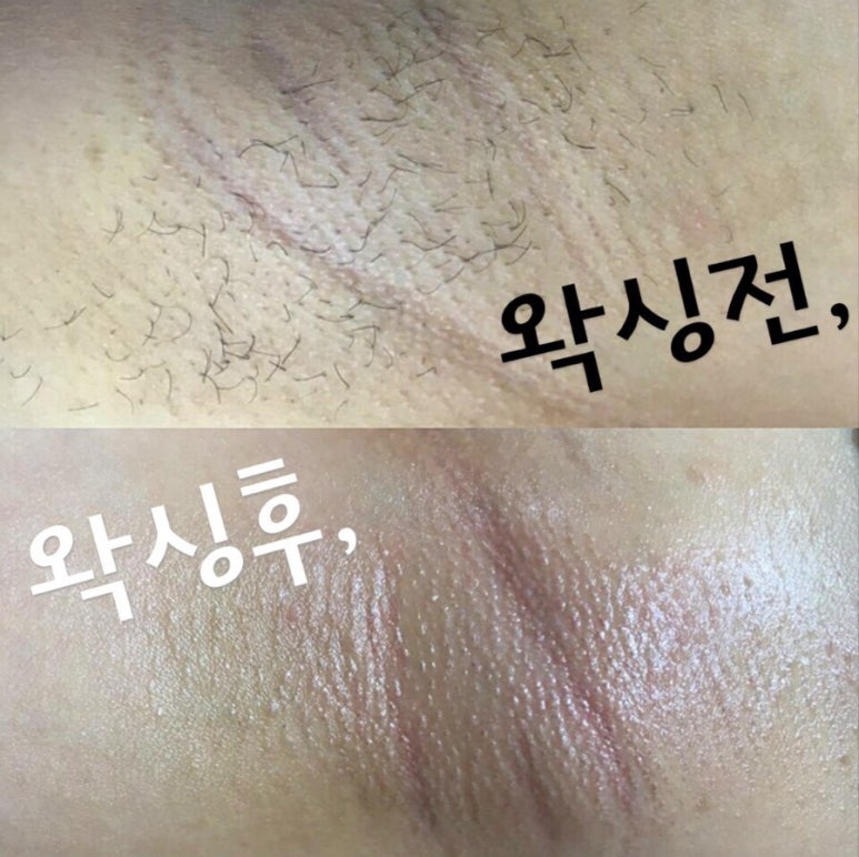 아라네일 이미지