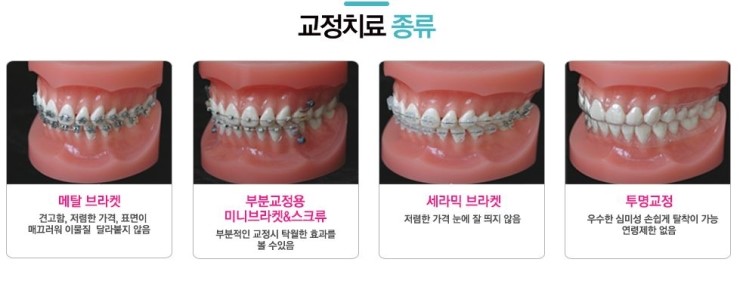 부여미소치과 이미지