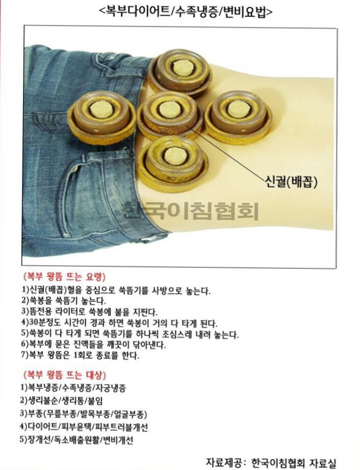 한국이침협회 이미지