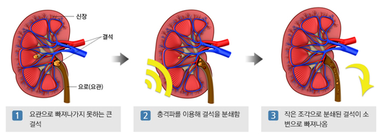 굿모닝비뇨기과의원 이미지