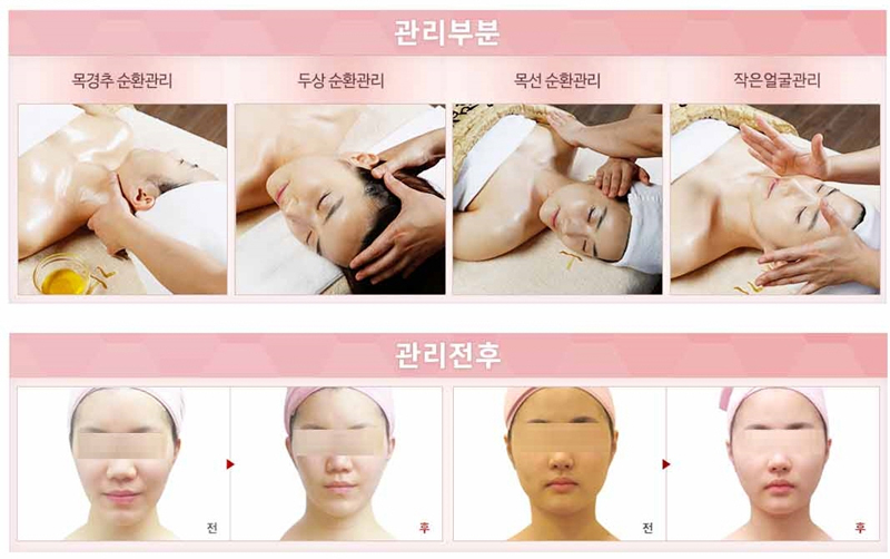 작은얼굴에스테틱 이미지