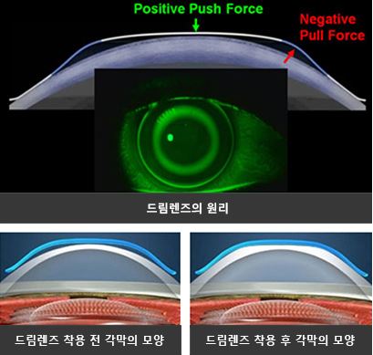 한사랑성모안과 이미지