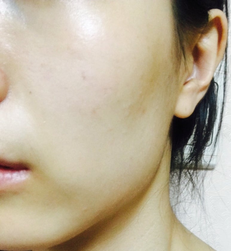 얼라이브피부과의원 이미지
