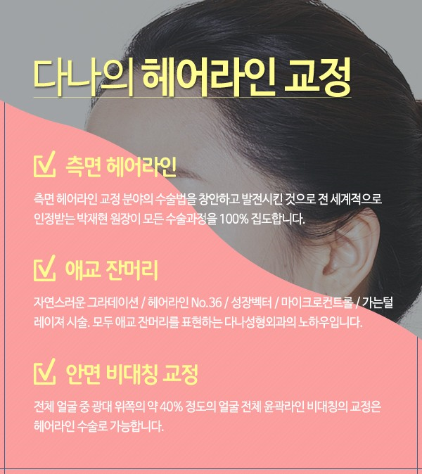 현헤어라인 이미지