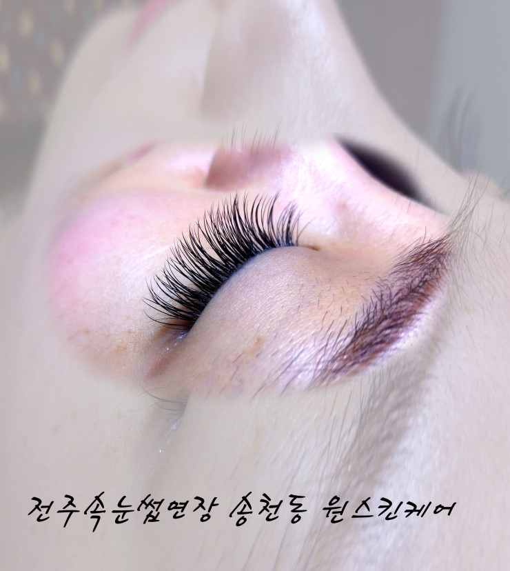 JC스킨케어 이미지