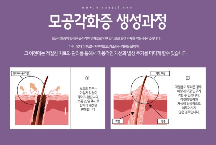 공피부과 이미지