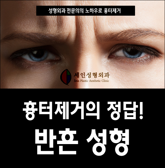 세인성형외과 이미지