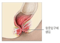 삼성항외과 이미지