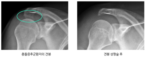 예루살렘정형외과 이미지