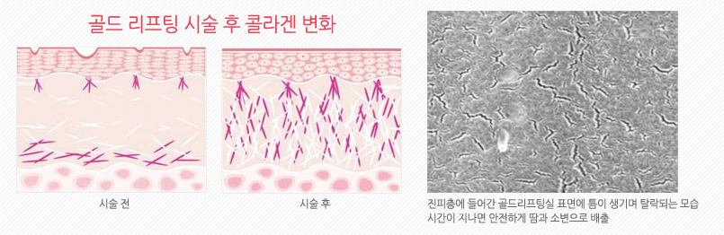 미애로여성의원 이미지