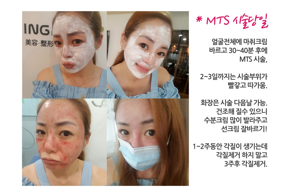 아이앤지랩 이미지