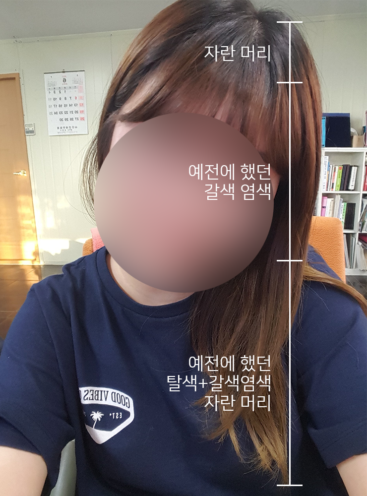현하윤헤어라인 이미지