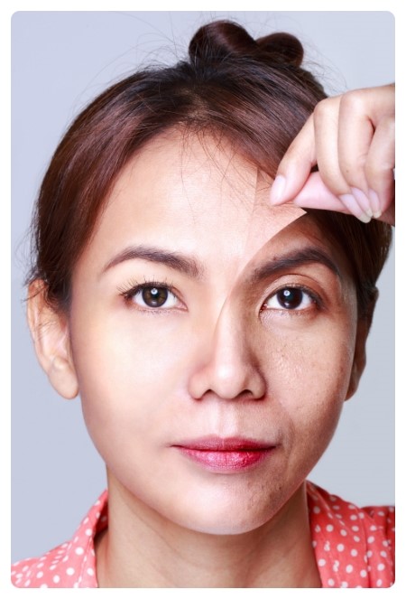 고운피부과 이미지