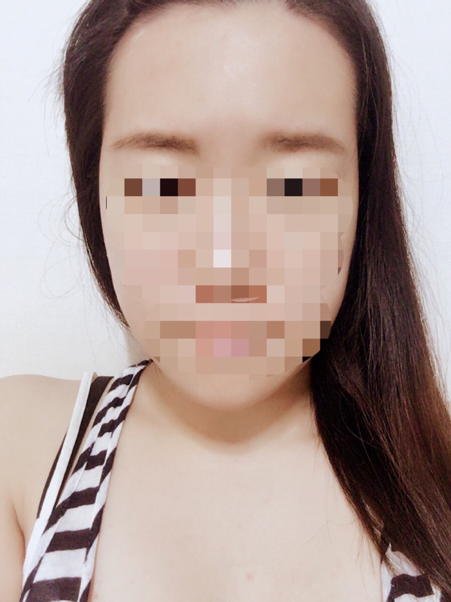Brown Skin(브라운스킨) 이미지